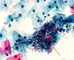 0e338566f3d66ddaa581afc4bef08baf